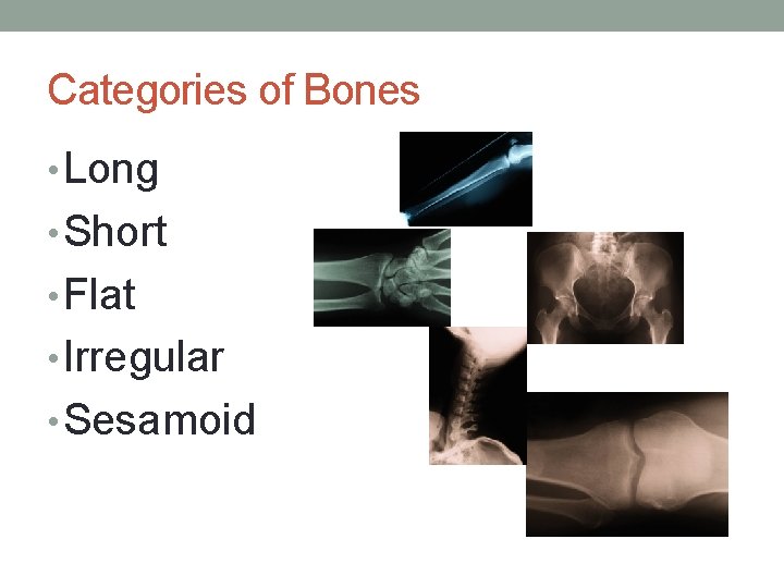 Categories of Bones • Long • Short • Flat • Irregular • Sesamoid 