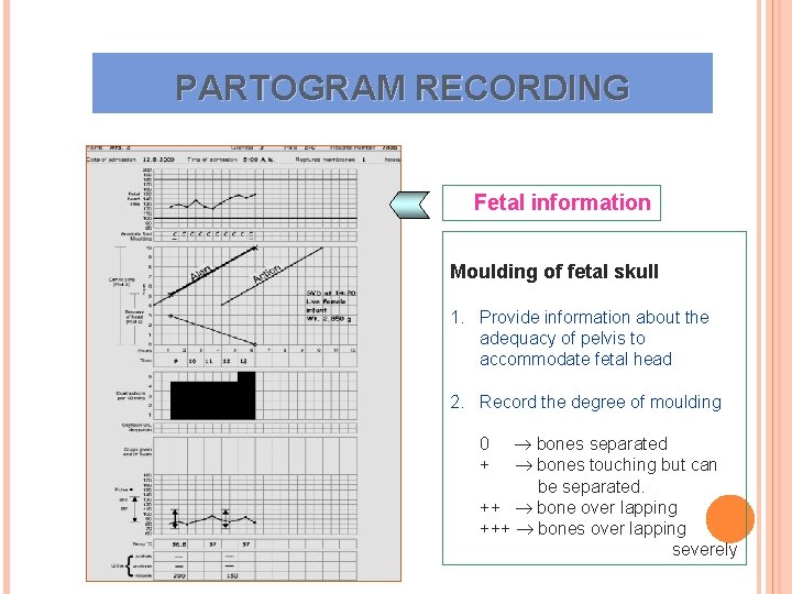 PARTOGRAM RECORDING Fetal information Moulding of fetal skull 1. Provide information about the adequacy PARTOGRAM RECORDING Fetal information Moulding of fetal skull 1. Provide information about the adequacy