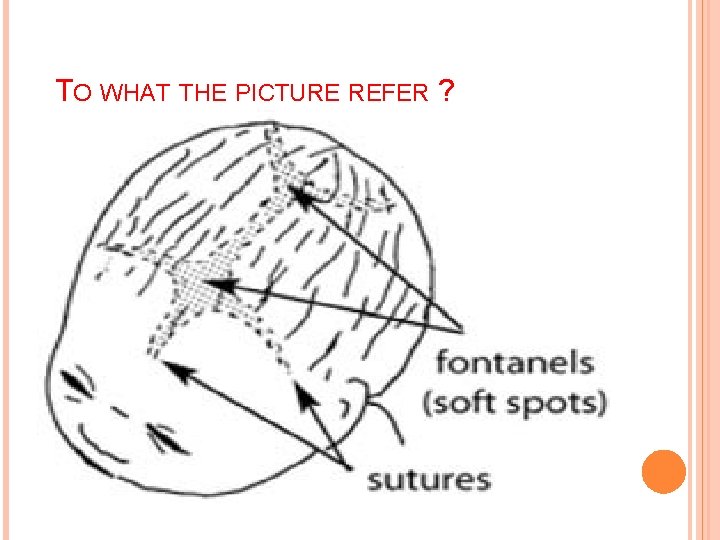 TO WHAT THE PICTURE REFER ? TO WHAT THE PICTURE REFER ?