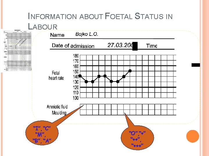 INFORMATION ABOUT FOETAL STATUS IN LABOUR “I”, “C” “M”, “B”, “A” “O”, “+” “++”, INFORMATION ABOUT FOETAL STATUS IN LABOUR “I”, “C” “M”, “B”, “A” “O”, “+” “++”,