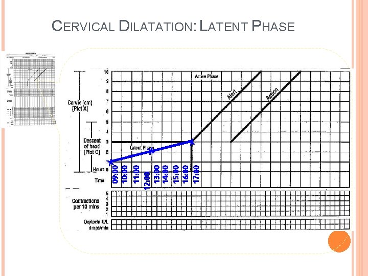 X 09: 00 10: 00 11: 00 12: 00 13: 00 14: 00 15: X 09: 00 10: 00 11: 00 12: 00 13: 00 14: 00 15: