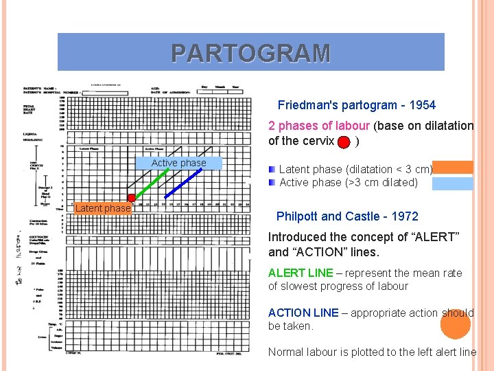 PARTOGRAM Friedman's partogram - 1954 2 phases of labour (base on dilatation of the PARTOGRAM Friedman's partogram - 1954 2 phases of labour (base on dilatation of the