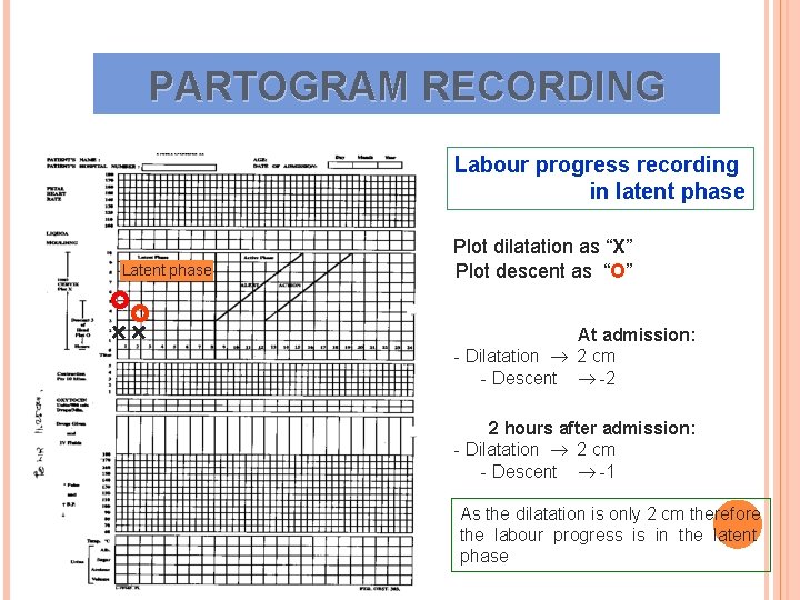 PARTOGRAM RECORDING Labour progress recording in latent phase Latent phase Plot dilatation as “X” PARTOGRAM RECORDING Labour progress recording in latent phase Latent phase Plot dilatation as “X”