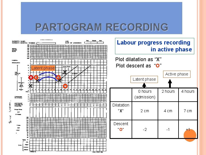 PARTOGRAM RECORDING Labour progress recording in active phase Plot dilatation as “X” Plot descent PARTOGRAM RECORDING Labour progress recording in active phase Plot dilatation as “X” Plot descent