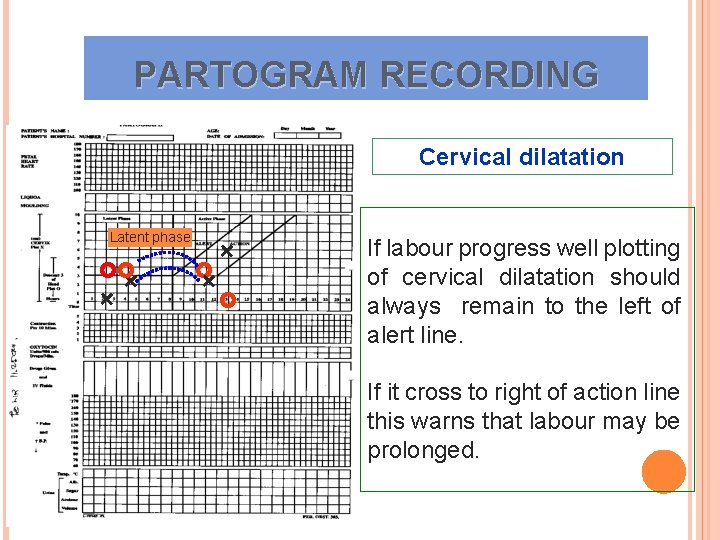 PARTOGRAM RECORDING Cervical dilatation Latent phase + + If labour progress well plotting of PARTOGRAM RECORDING Cervical dilatation Latent phase + + If labour progress well plotting of