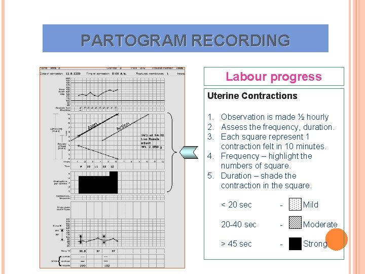 PARTOGRAM RECORDING Labour progress Uterine Contractions 1. Observation is made ½ hourly 2. Assess PARTOGRAM RECORDING Labour progress Uterine Contractions 1. Observation is made ½ hourly 2. Assess