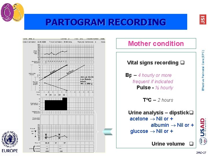 PARTOGRAM RECORDING Vital signs recording q Bp – 4 hourly or more frequent if PARTOGRAM RECORDING Vital signs recording q Bp – 4 hourly or more frequent if