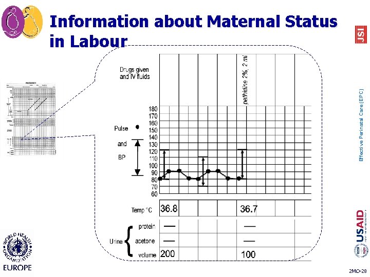 Effective Perinatal Care (EPC) Information about Maternal Status in Labour 2 MO-28 Effective Perinatal Care (EPC) Information about Maternal Status in Labour 2 MO-28