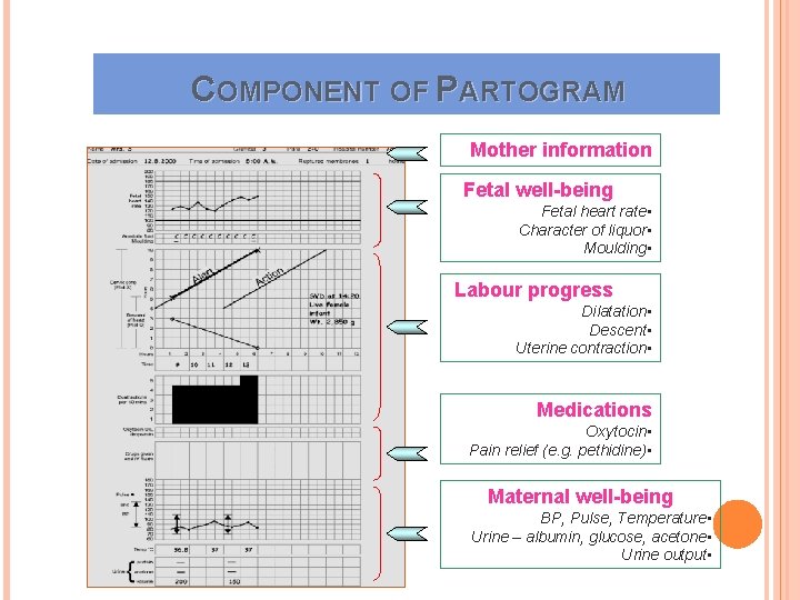 COMPONENT OF PARTOGRAM Mother information Fetal well-being Fetal heart rate • Character of liquor COMPONENT OF PARTOGRAM Mother information Fetal well-being Fetal heart rate • Character of liquor