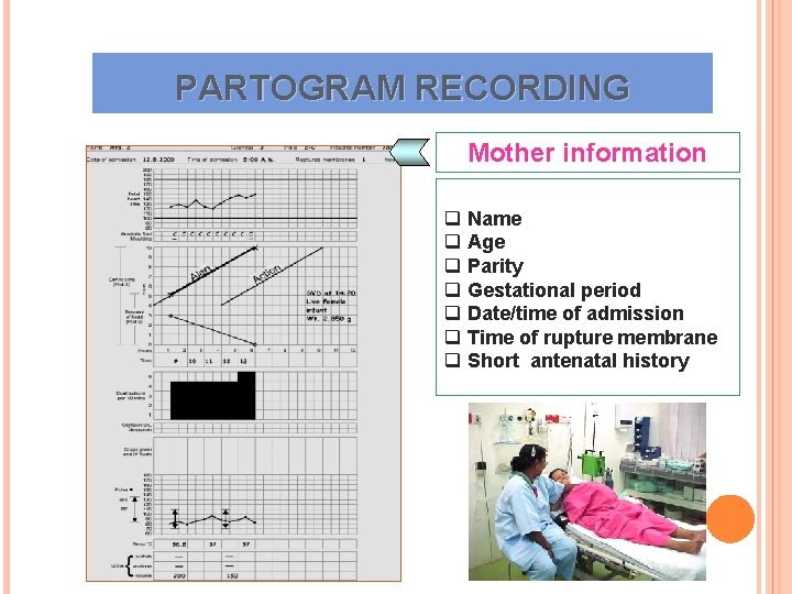 PARTOGRAM RECORDING Mother information q Name q Age q Parity q Gestational period q PARTOGRAM RECORDING Mother information q Name q Age q Parity q Gestational period q