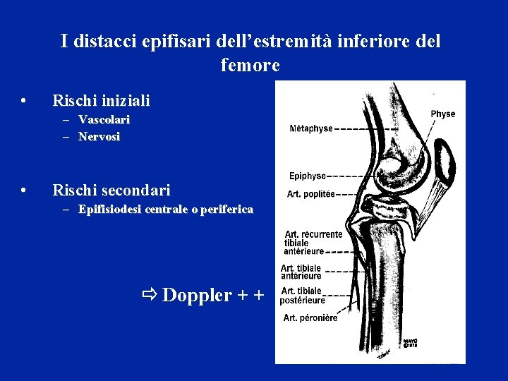 I distacci epifisari dell’estremità inferiore del femore • Rischi iniziali – Vascolari – Nervosi