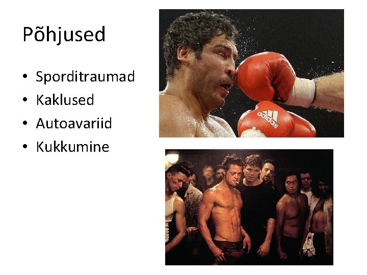 Põhjused • • Sporditraumad Kaklused Autoavariid Kukkumine 