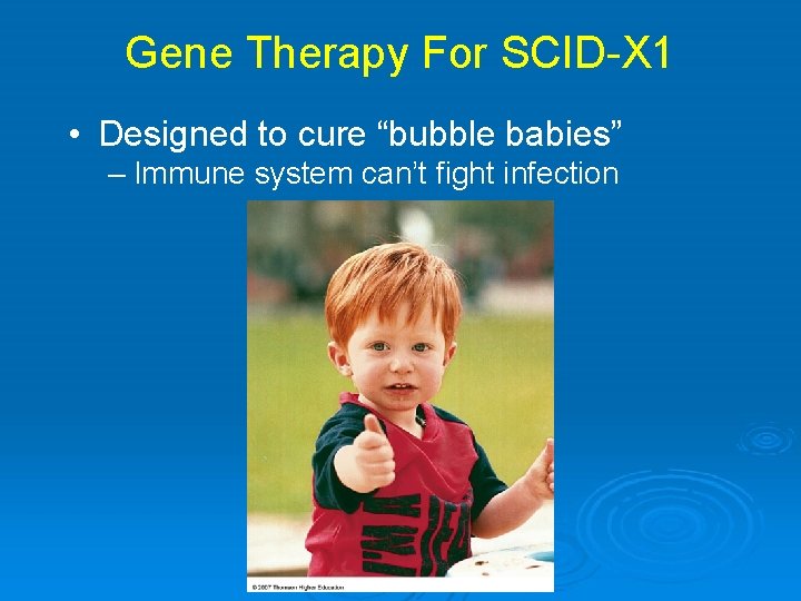 Gene Therapy For SCID-X 1 • Designed to cure “bubble babies” – Immune system