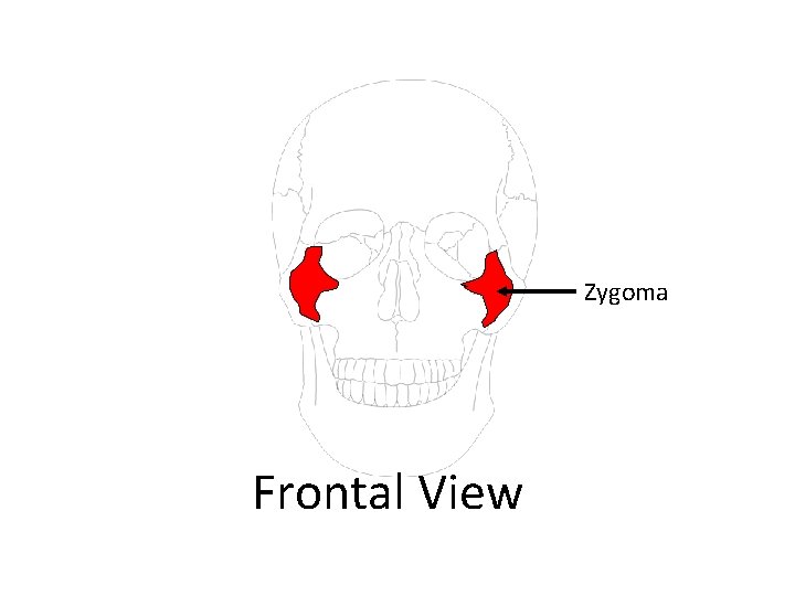Zygoma Frontal View 