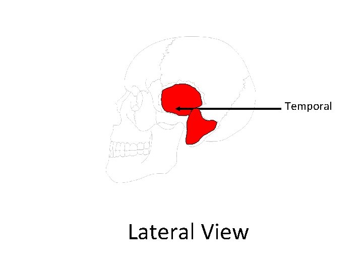 Temporal Lateral View 