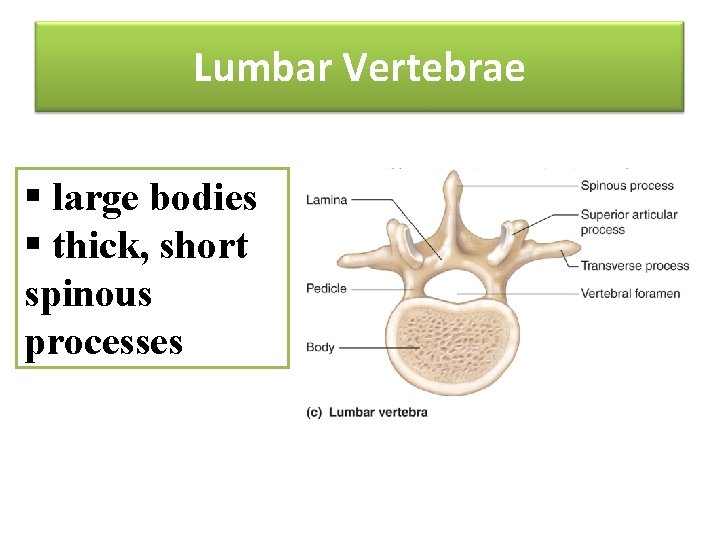 Lumbar Vertebrae § large bodies § thick, short spinous processes 