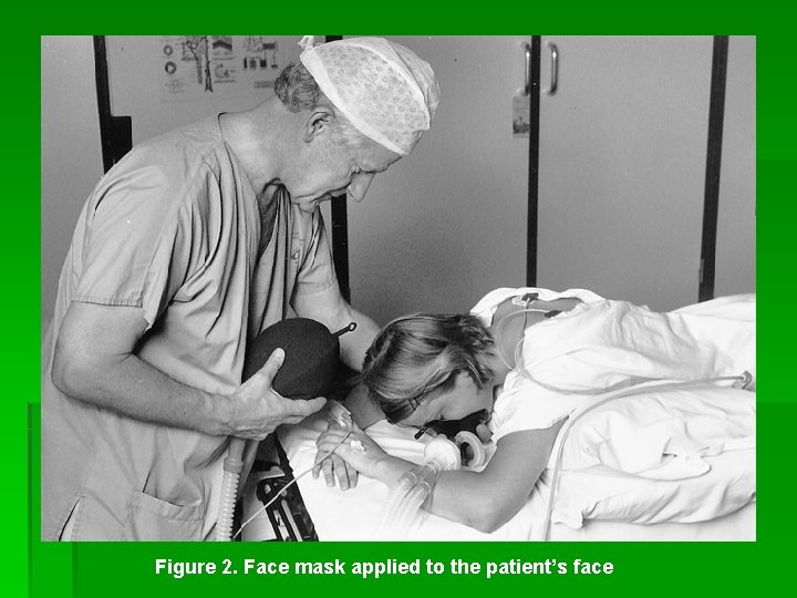 Figure 2. Face mask applied to the patient’s face 