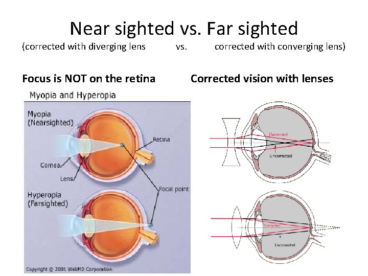 Near sighted vs. Far sighted (corrected with diverging lens Focus is NOT on the