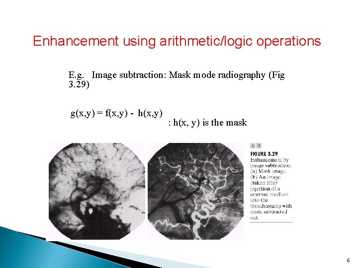 Enhancement using arithmetic/logic operations E. g. Image subtraction: Mask mode radiography (Fig 3. 29)