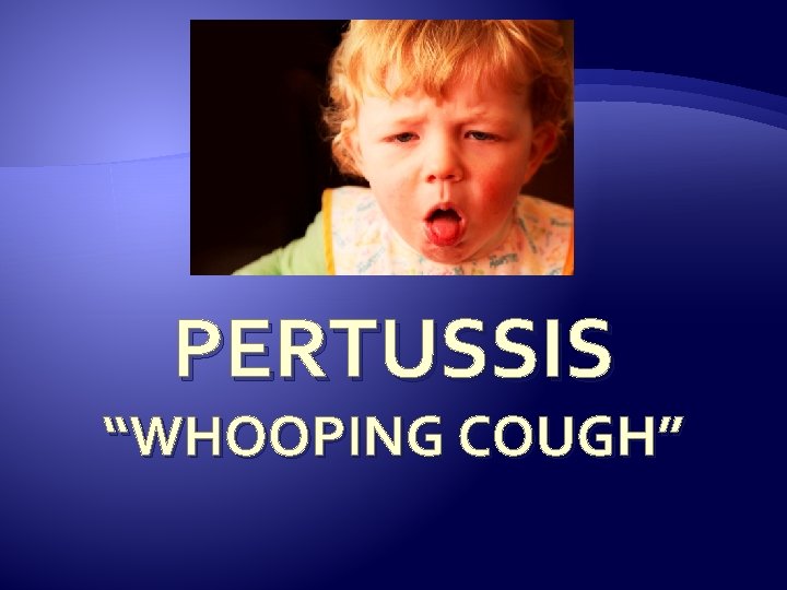 PERTUSSIS “WHOOPING COUGH” 