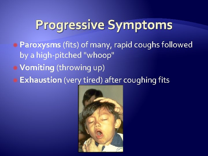 Progressive Symptoms Paroxysms (fits) of many, rapid coughs followed by a high-pitched "whoop" Vomiting