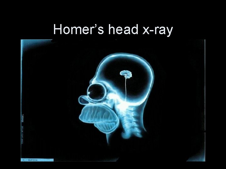 Homer’s head x-ray 