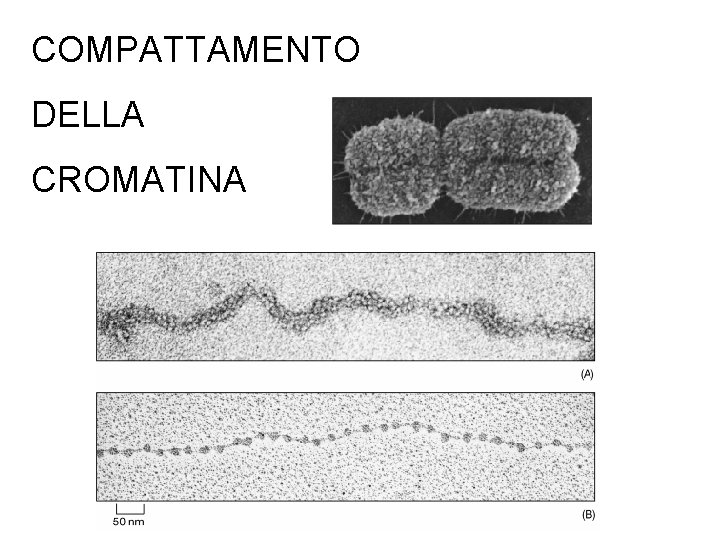 COMPATTAMENTO DELLA CROMATINA 