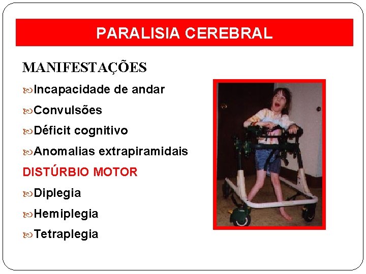 PARALISIA CEREBRAL MANIFESTAÇÕES Incapacidade de andar Convulsões Déficit cognitivo Anomalias extrapiramidais DISTÚRBIO MOTOR Diplegia