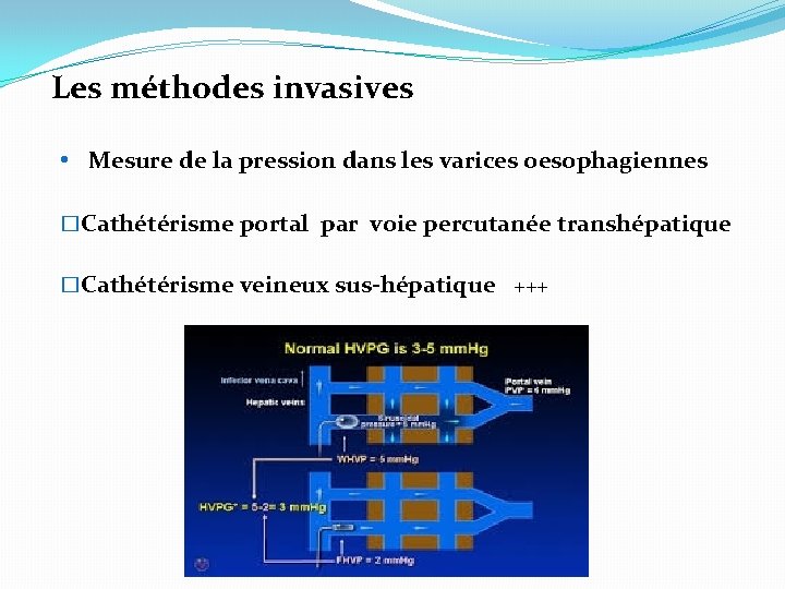 Les méthodes invasives • Mesure de la pression dans les varices oesophagiennes �Cathétérisme portal