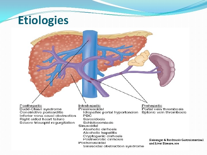 Etiologies Sleisenger & Fordtran's Gastrointestinal and Liver Disease, 10 e 