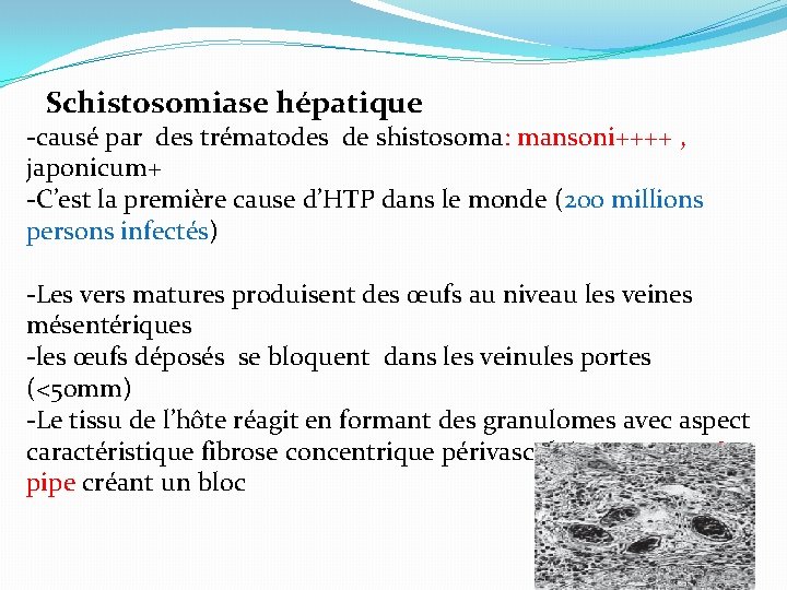 Schistosomiase hépatique -causé par des trématodes de shistosoma: mansoni++++ , japonicum+ -C’est la première