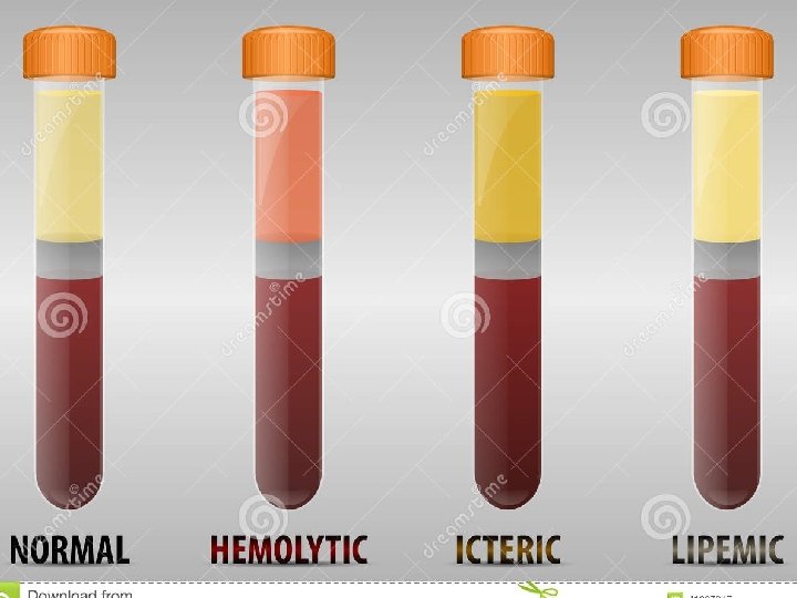 Accreditation An institution or a program meets standards of quality set forth by an