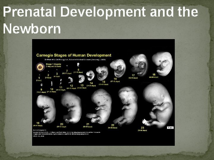 Prenatal Development and the Newborn 