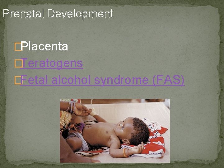 Prenatal Development �Placenta �Teratogens �Fetal alcohol syndrome (FAS) 