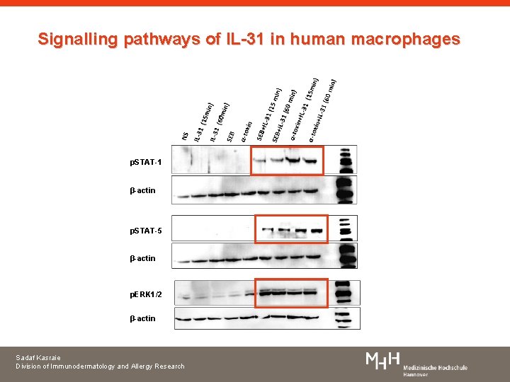 Signalling pathways of IL-31 in human macrophages p. STAT-1 β-actin p. STAT-5 β-actin p.