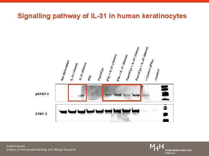 Signalling pathway of IL-31 in human keratinocytes p. STAT-3 Sadaf Kasraie Division of Immunodermatology
