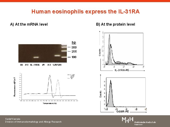 Human eosinophils express the IL-31 RA A) At the m. RNA level Sadaf Kasraie