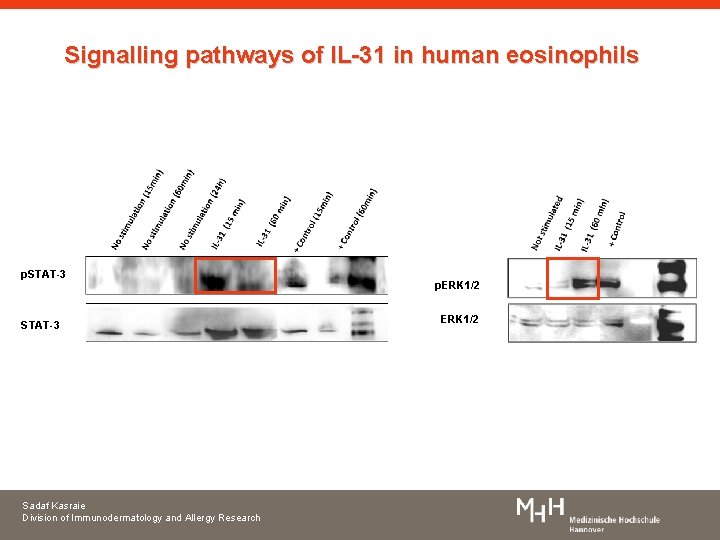 Signalling pathways of IL-31 in human eosinophils p. STAT-3 Sadaf Kasraie Division of Immunodermatology