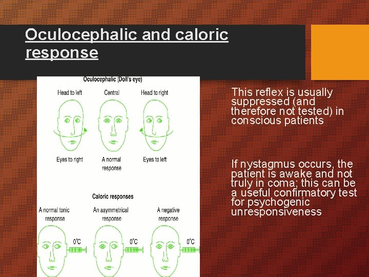 Oculocephalic and caloric response This reflex is usually suppressed (and therefore not tested) in Oculocephalic and caloric response This reflex is usually suppressed (and therefore not tested) in