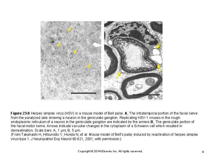 Figure 23 -8 Herpes simplex virus (HSV) in a mouse model of Bell palsy.