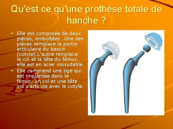 Qu'est ce qu'une prothèse totale de hanche ? Elle est composée de deux pièces,