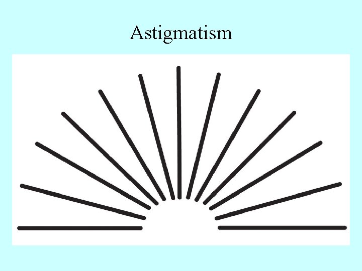 Astigmatism 