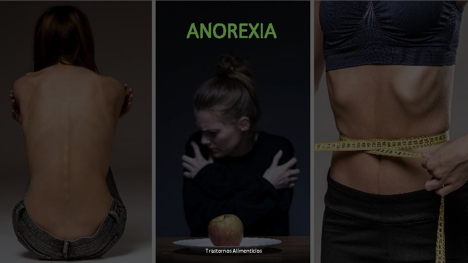 ANOREXIA Trastornos Alimenticios 