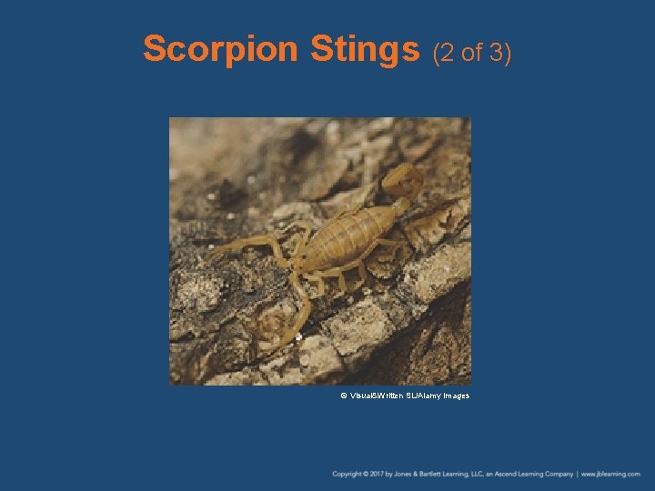 Scorpion Stings (2 of 3) © Visual&Written SL/Alamy Images 