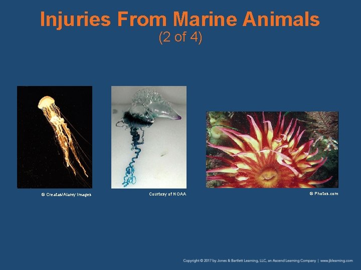 Injuries From Marine Animals (2 of 4) © Creatas/Alamy Images Courtesy of NOAA © Injuries From Marine Animals (2 of 4) © Creatas/Alamy Images Courtesy of NOAA ©