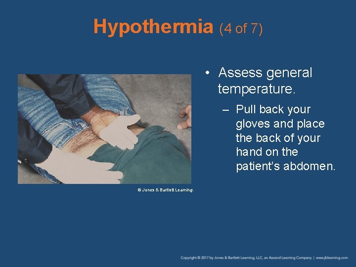 Hypothermia (4 of 7) • Assess general temperature. – Pull back your gloves and Hypothermia (4 of 7) • Assess general temperature. – Pull back your gloves and