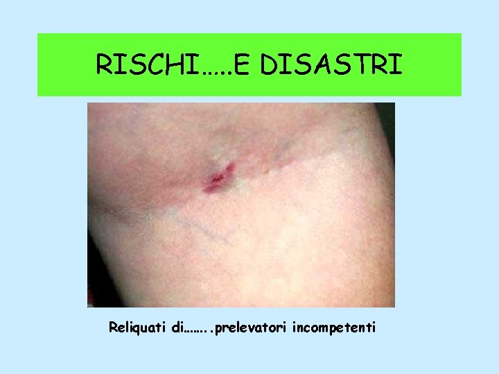 RISCHI…. . E DISASTRI Reliquati di……. . prelevatori incompetenti 