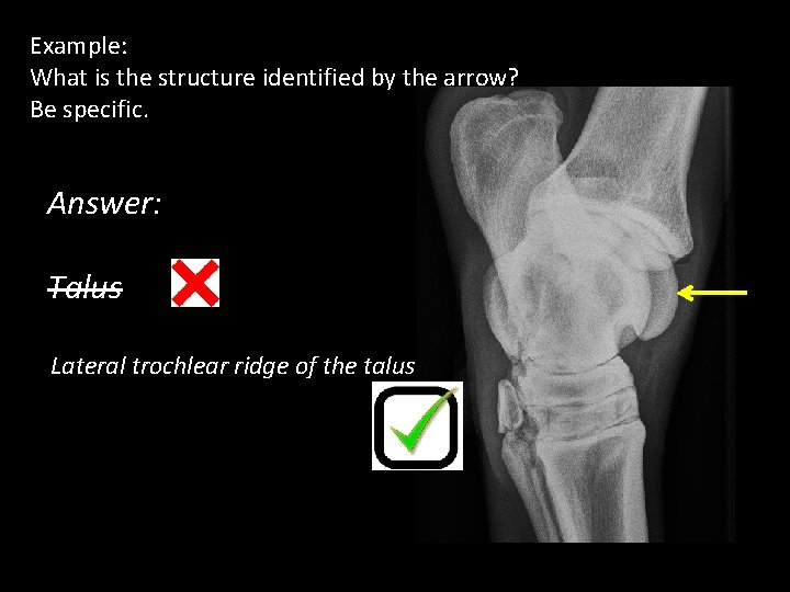 Example: What is the structure identified by the arrow? Be specific. Answer: Talus Lateral