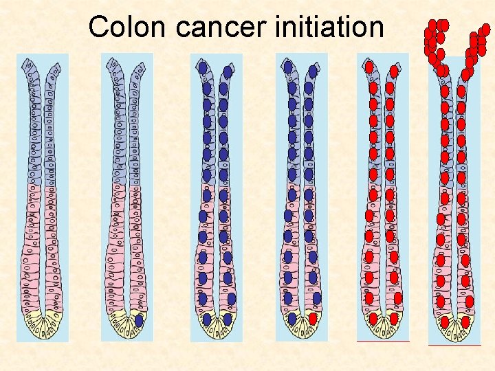 Colon cancer initiation 