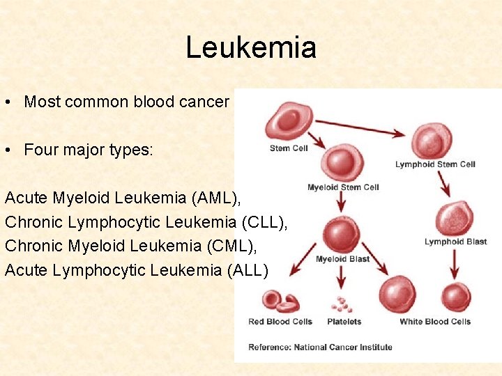 Leukemia • Most common blood cancer • Four major types: Acute Myeloid Leukemia (AML),